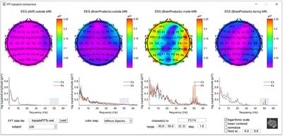 Quantitative Analyses Help in Choosing Between Simultaneous vs. Separate EEG and fMRI
